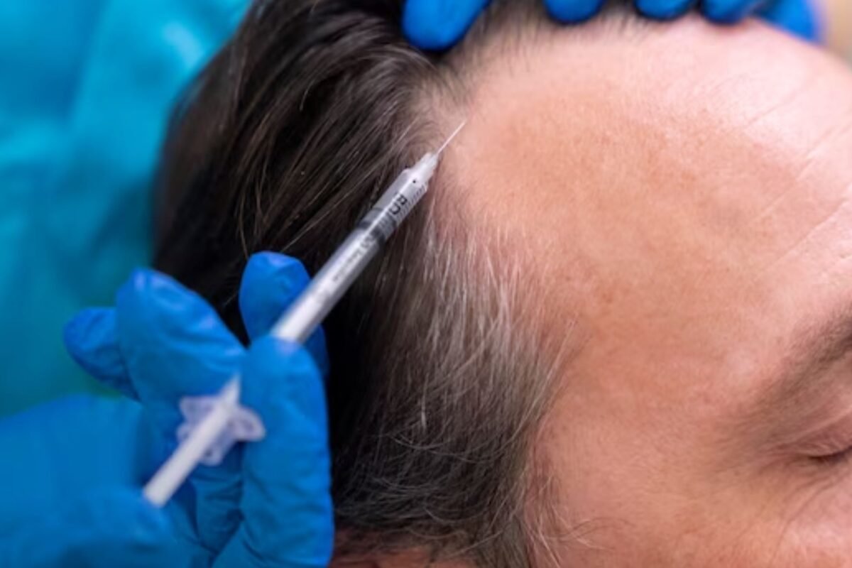 Mesotherapy Session